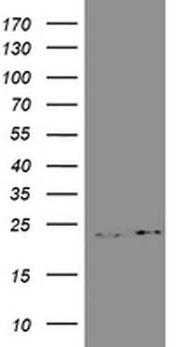 GSTP1 Monoclonal Antibody (OTI10H1), TrueMAB , OriGene 100 &mu;L; Unconjugated:Antibodies,
