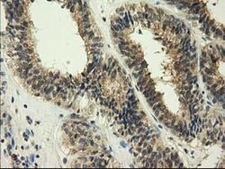 GSTT2 Mouse anti-Human, Clone: OTI6B7, lyophilized, TrueMAB 100 &mu;g;