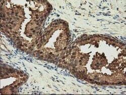 GSTT2 Mouse anti-Human, Clone: OTI6B7, lyophilized, TrueMAB 100 &mu;g;
