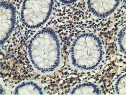 GSTT2 Mouse anti-Human, Clone: OTI6B7, lyophilized, TrueMAB 100 &mu;g;