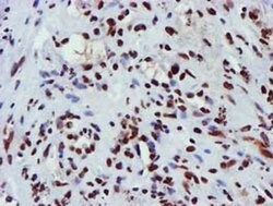 GSTT2 Monoclonal Antibody (OTI3B6), TrueMAB , OriGene 100 &mu;L; Unconjugated:Antibodies,
