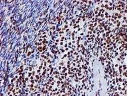 GSTT2 Monoclonal Antibody (OTI3B6), TrueMAB , OriGene:Antibodies:Primary