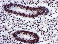 GSTT2 Monoclonal Antibody (OTI3B6), TrueMAB , OriGene 100 &mu;L; Unconjugated:Antibodies,