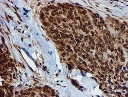 GSTT2 Monoclonal Antibody (OTI3B6), TrueMAB , OriGene 100 &mu;L; Unconjugated:Antibodies,