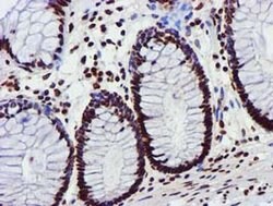 GSTT2 Monoclonal Antibody (OTI3B6), TrueMAB , OriGene:Antibodies:Primary