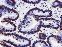 GSTT2 Monoclonal Antibody (OTI3B6), TrueMAB , OriGene 100 &mu;L; Unconjugated:Antibodies,