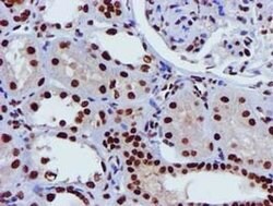 GSTT2 Monoclonal Antibody (OTI3B6), TrueMAB , OriGene 100 &mu;L; Unconjugated:Antibodies,