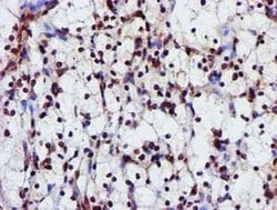 GSTT2 Monoclonal Antibody (OTI3B6), TrueMAB , OriGene 100 &mu;L; Unconjugated:Antibodies,