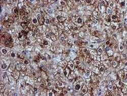 GSTT2 Monoclonal Antibody (OTI3B6), TrueMAB , OriGene 100 &mu;L; Unconjugated:Antibodies,