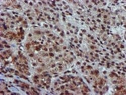 GSTT2 Monoclonal Antibody (OTI3B6), TrueMAB , OriGene 100 &mu;L; Unconjugated:Antibodies,