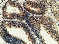 GSTT2 Monoclonal Antibody (OTI7A12), TrueMAB , OriGene 100 &mu;L; Unconjugated:Antibodies,