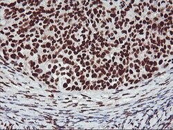 GSTT2 Mouse anti-Human, Clone: OTI6C4, lyophilized, TrueMAB 100 &mu;g;