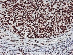 GSTT2 Monoclonal Antibody (OTI6C4), TrueMAB , OriGene 30 &mu;L; Unconjugated:Antibodies,