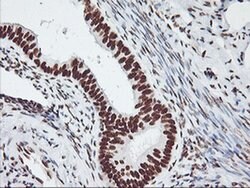 GSTT2 Monoclonal Antibody (OTI6C4), TrueMAB , OriGene:Antibodies:Primary