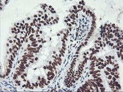 GSTT2 Mouse anti-Human, Clone: OTI6C4, lyophilized, TrueMAB 100 &mu;g;