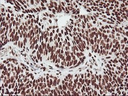 GSTT2 Mouse anti-Human, Clone: OTI6C4, lyophilized, TrueMAB 100 &mu;g;
