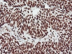 GSTT2 Monoclonal Antibody (OTI6C4), TrueMAB , OriGene 30 &mu;L; Unconjugated:Antibodies,