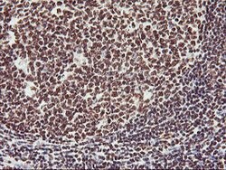 GSTT2 Mouse anti-Human, Clone: OTI6C4, lyophilized, TrueMAB 100 &mu;g;