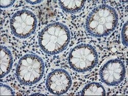 GSTT2 Monoclonal Antibody (OTI5A11), TrueMAB , OriGene 30 &mu;L; Unconjugated:Antibodies,