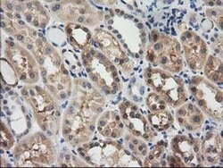 GSTT2 Monoclonal Antibody (OTI5A11), TrueMAB , OriGene 30 &mu;L; Unconjugated:Antibodies,