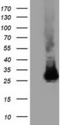 GSTT2 Mouse anti-Human, Clone: OTI6B7, lyophilized, TrueMAB 100 &mu;g;
