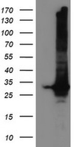 GSTT2 Monoclonal Antibody (OTI3B6), TrueMAB , OriGene 100 &mu;L; Unconjugated:Antibodies,