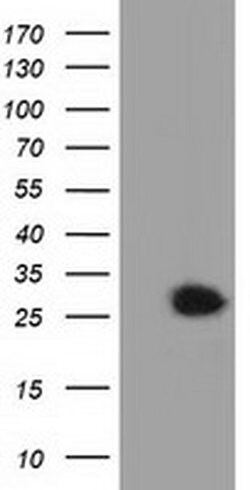 GSTT2 Monoclonal Antibody (OTI7A12), TrueMAB , OriGene 100 &mu;L; Unconjugated:Antibodies,