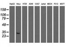 GSTT2 Monoclonal Antibody (OTI7A12), TrueMAB , OriGene 100 &mu;L; Unconjugated:Antibodies,