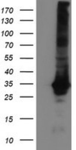 GSTT2 Mouse anti-Human, Clone: OTI6C4, lyophilized, TrueMAB 100 &mu;g;