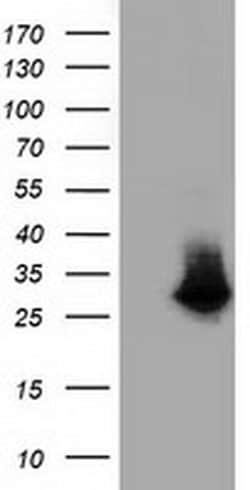 GSTT2 Monoclonal Antibody (OTI5A11), TrueMAB , OriGene 30 &mu;L; Unconjugated:Antibodies,