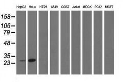 GSTT2 Monoclonal Antibody (OTI5A11), TrueMAB , OriGene 30 &mu;L; Unconjugated:Antibodies,
