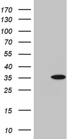 GSTZ1 Monoclonal Antibody (OTI1A7), TrueMAB , OriGene 100 &mu;L; Unconjugated:Antibodies,
