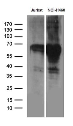 GTF2A1L Monoclonal Antibody (OTI1D3), TrueMAB , OriGene:Anticuerpos:Anticuerpos