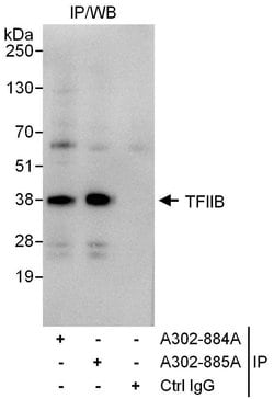 GTF2B/TFIIB Rabbit anti-Human, Polyclonal, Bethyl Laboratories 100 &mu;L;