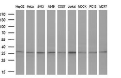 GTF2B Mouse anti-Human, Clone: OTI2A7, lyophilized, TrueMAB 100 &mu;g;