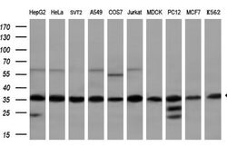 GTF2B Monoclonal Antibody (OTI5B6), TrueMAB , OriGene 100 &mu;L; Unconjugated:Antibodies,