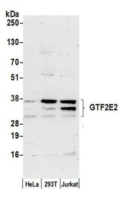 GTF2E2/TF2E2/TFIIE-beta Polyclonal Antibody, Bethyl Laboratories 20 &mu;L | Buy Online | Bethyl Laboratories, Inc | Fisher Scientific