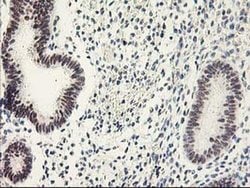 GTF2F1 Monoclonal Antibody (OTI4B10), TrueMAB , OriGene 100 &mu;L; Unconjugated:Antibodies,