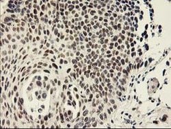 GTF2F1 Monoclonal Antibody (OTI4B10), TrueMAB , OriGene 100 &mu;L; Unconjugated:Antibodies,