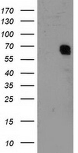 GTF2F1 Monoclonal Antibody (OTI4B10), TrueMAB , OriGene 100 &mu;L; Unconjugated:Antibodies,