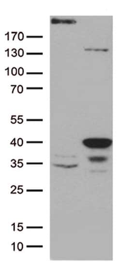 GTF2H3 Monoclonal Antibody (OTI4B5), TrueMAB , OriGene 100 &mu;L; Unconjugated:Antibodies,