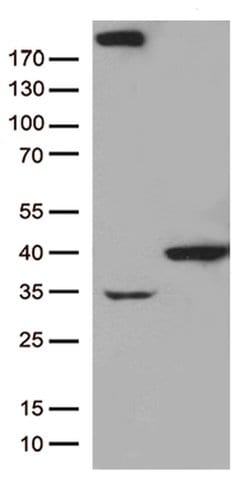 GTF2H3 Monoclonal Antibody (OTI6E12), TrueMAB , OriGene:Antibodies:Primary