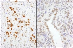 GTF2I/TFII-I Rabbit anti-Human, Mouse, Polyclonal, Bethyl Laboratories