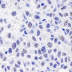 GTF2I/TFII-I Polyclonal Antibody, Bethyl Laboratories 10 &mu;L | Buy Online | Bethyl Laboratories, Inc | Fisher Scientific
