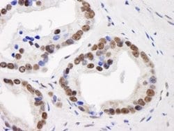 GTF2I/TFII-I Polyclonal Antibody, Bethyl Laboratories 10 &mu;L | Buy Online | Bethyl Laboratories, Inc | Fisher Scientific