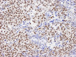 GTF2I/TFII-I Polyclonal Antibody, Bethyl Laboratories 10 &mu;L | Buy Online | Bethyl Laboratories, Inc | Fisher Scientific