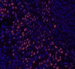 GTF2I/TFII-I Polyclonal Antibody, Bethyl Laboratories 10 &mu;L | Buy Online | Bethyl Laboratories, Inc | Fisher Scientific