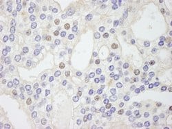 GTF2IRD/TFII-IRD1 Polyclonal Antibody, Bethyl Laboratories 10 &mu;L; Unconjugated:Antibodies,