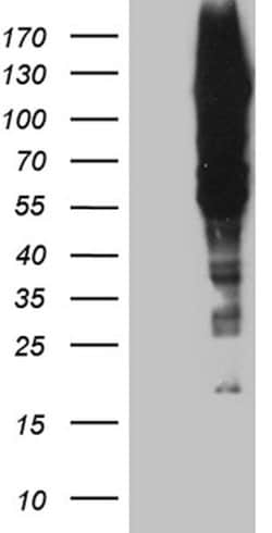 GTF2IRD1 Monoclonal Antibody (OTI9A3), TrueMAB , OriGene 100 &mu;L; Unconjugated:Antibodies,