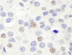 GTF3C1/TFIIIC220 Rabbit anti-Human, Polyclonal, Bethyl Laboratories 10